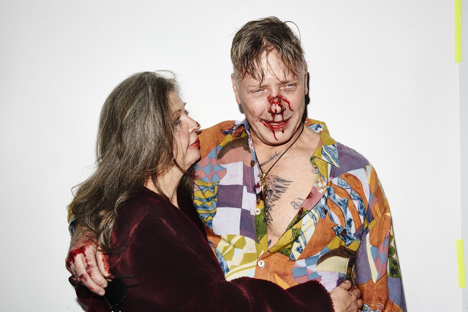 a man with bloody face and nose