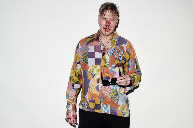 a man with a bloody face and sunglasses